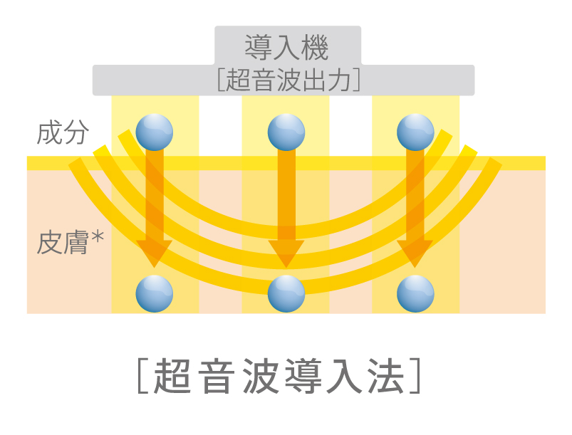 54bf02e67ce8d
